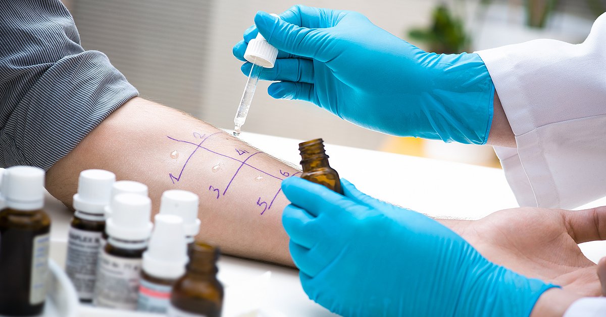 Skin prick allergy test Durchführung eines Prick-Tests auf der Innenseite eines Unterarms